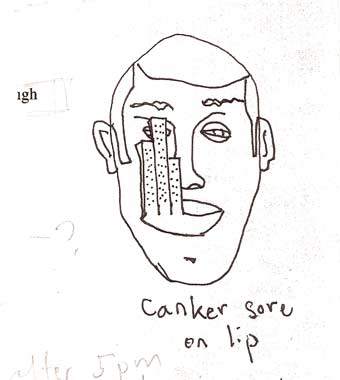 cankersore.jpg